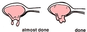jelly dropping off the side of a spoon, left, 2 drops, almost done, right, sheet, done